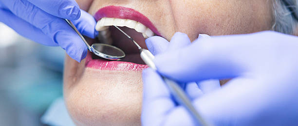 Best Emergency Treatment for Dental Infections or Abscesses in Tuscarawas, OH
